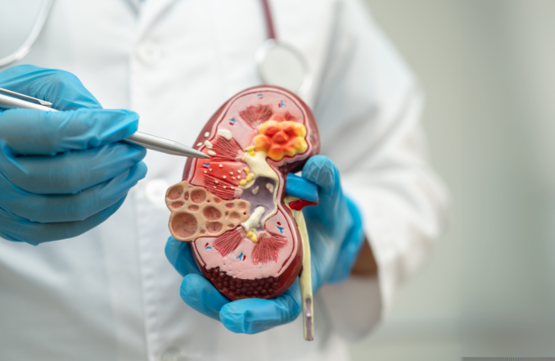 Nephrology